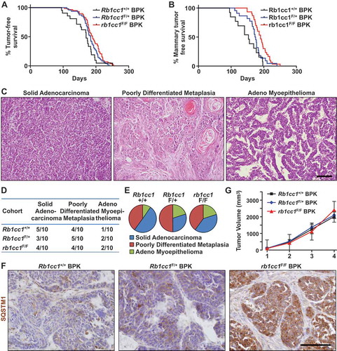 Figure 1. Rb1cc1 deletion inhibits the onset of brca1F/F; trp53F/F; K14-Cre (BPK) mammary tumors. (a) Tumor free survival curves of BPK mice with either Rb1cc1+/+ (n = 21), Rb1cc1F/+ (n = 48) or rb1cc1F/F (n = 58) alleles. (b) Tumor-free survival curves of BPK mice bearing only mammary tumors and not skin or other tumors, with either Rb1cc1+/+ (n = 13), Rb1cc1F/+ (n = 22) or rb1cc1F/F (n = 30) alleles. (c) Histological subtypes of mammary tumors from BPK mice. Scale bar: 200 μm. (d) Table and (e) pie charts showing distribution of histological subtypes for mammary tumors from BPK mice with either Rb1cc1+/+, Rb1cc1F/+ or rb1cc1F/F alleles. (f) Representative images for mammary tumor sections from BPK mice with either Rb1cc1+/+, Rb1cc1F/+ or rb1cc1F/F alleles that were immuno-stained for SQSTM1. Scale bar: 200 μm. (g) Tumor growth curves of BPK mice with either Rb1cc1+/+ (n = 6), Rb1cc1F/+ (n = 12) or rb1cc1F/F (n = 17) alleles.