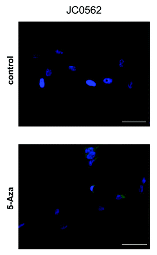 Figure 3. The REG1A protein expression of melanoma lines. The REG1A protein expression of control and 5-Aza treated melanoma lines were evaluated by fluorescence immunocytochemistry analysis. REG1A protein was labeled with Alexa Fluor 488 (green) and nuclei were labeled with DAPI (blue). (A) Control line (DMSO only; MS = 42.8%,). (B) corresponding 5-Aza treated lines (MS = 17.8%). Bar represents 20 μm. MS(%) = CpG #6 Methylation Status