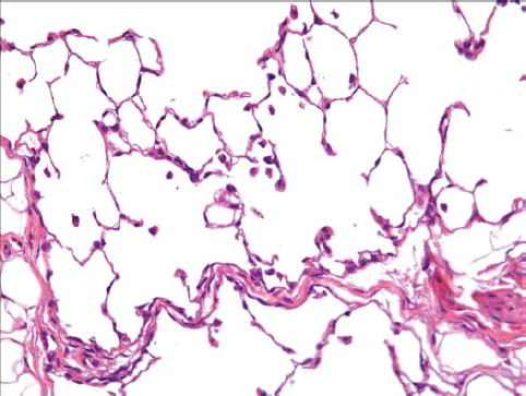 FIG. 15  Histopathological photo of lung from a group 3 rat exposed to chrysotile and the sanded component (40× magnification). An increased number of macrophages are observed with sometimes two or three per alveolus.