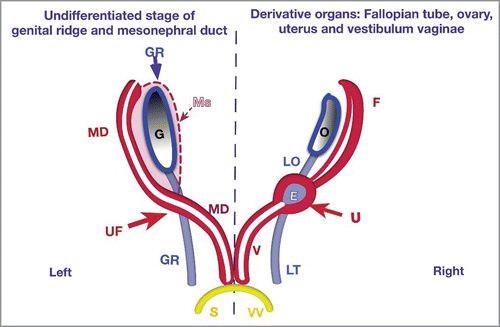 FIGURE 1. New Theory of Uterovaginal Embryogenesis. Schematic studies of the embryogenesis of the uterus (U) and vagina (V) from the gonadal ridges (GR) and mesonephral ducts (MD). Vestibulum vaginae (VV – yellow) from sinus urogenitalis (S).There are two pairs of ducts:  on the left side - pairs of ducts in undifferentiated stages; and on the right side – corresponding uterine and vaginal derivatives.The gonadal ridges (GR-blue), as longitudinal pairs, grow caudally. The upper parts (before intersection with mesonephral ducts) form gonads (ovaries) and ligamentum ovary (LO); the lower part forms the ligamentum teres uteri (LT). Mesonephros (Ms) reduces in female embryo. The upper part of the mesonephral duct (MD- red) lies on the paramedial (lateral) sides of the GR and become the Fallopian tubes (F). The area of intersection between the mesonephral ducts with the gonadal ridge develops into the uterine fold (UF) with the endometrial (E) cavity inside. Below of the UF, both mesonephral ducts (MD) form the vagina. They grow caudally and conjoin together in the midline and pass into the sinus urogenitalis (S). The vestibulum vaginae (VV) derives from the sinus urogenitalis (S-yellow).