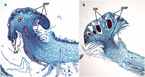 Figure 9. Gametangiophores of Marchantia. (A) Longitudinal section though an archegoniophore (ARP) showing several archegonia (AR). T: thallus; S: scales; R: rhizoids. (B) Longitudinal section through an antheridiophore (ANP) and male antheridia (AN). T: thallus. Images were obtained from slides and used with permission from Carolina Biological Supply, Whitsett, North Carolina, Copyright Carolina Biological Supply.