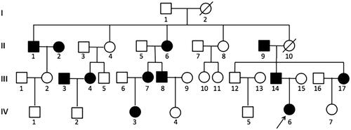 Figure 2. Family pedigree. The black arrow indicates the proband; Black filled symbols: subjects with hypertension. Empty symbols: without hypertension. Seventeen family members are further included in this study：II-1, II-2, II-5, II-6, II-9, III-2, III-3, III-4, III-6, III-7, III-8, III-14, III-15, III-17, IV-2, IV-3, IV-6; Eleven subjects accepted gene test: II-1, II-6, II-9, III-2, III-7, III-8, III-14, III-15, III-17, IV-3, IV-6; Slash indicates passed away due to cerebrovascular accident.