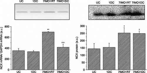 Figure 1  Effect of cold and immobilization alone or consecutively on NCX1 mRNA (left) and protein (right) levels in the kidney. UC—untreated control, 1DC—exposure to 4°C for 1 day, 7IMO1RT—daily exposure to immobilization for 7 days, 2 h per day with subsequent rest for 1 day at room temperature, 7IMO1DC—daily immobilization for 7 days, 2 h per day with subsequent exposure to cold for 1 day. Values are group mean ± SEM; n, 6–8 rats per group. One-way ANOVA: p = 1.191 × 10− 5, F = 27.3625 (left), p = 3.938 × 10− 5, F = 21.6354 (right). *p < 0.05 and **p < 0.01 vs. UC; ++p < 0.01 vs. 7IMO1RT.