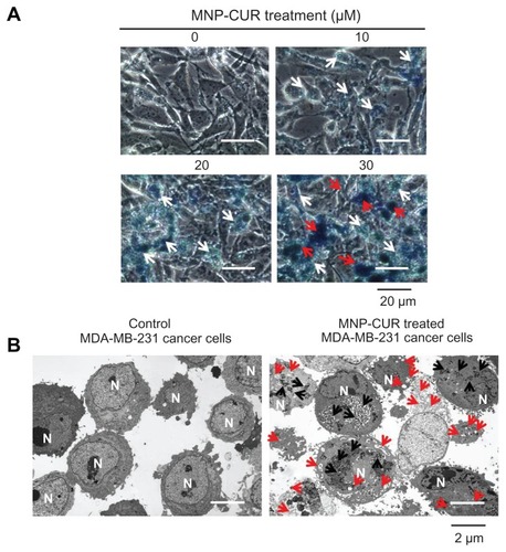 Figure 2 Curcumin-loaded magnetic nanoparticle formulation improves curcumin cellular uptake. (A) Phase contrast images of MDA-MB-231 cancer cells treated with curcumin-loaded magnetic nanoparticle formulation (0–30 μM). The intensity of blue stain produced by Prussian blue from the iron of curcumin-loaded magnetic nanoparticle formulation helps improve visualization of internalized nanoparticles of curcumin-loaded magnetic nanoparticle formulation. White arrows highlight less internalization of nanoparticles and red arrows indicate greater accumulation of nanoparticles. (B) Transmission electron microscopic images of free MDA-MB-231 cells and MDA-MB-231 cells incubated with curcumin-loaded magnetic nanoparticle formulation (20 μM) for 6 hours. Black arrows indicate the accumulation and internalized nanoparticles (curcumin-loaded magnetic nanoparticle formulation) and red arrows represent the vacuole and lysosomal activity which induces apoptosis. Abbreviations: MNP-CUR, curcumin-loaded magnetic nanoparticle formulation; N, nucleus.