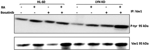 Figure 6. Regulation of Vav1 tyrosine phosphorylation in HL-60 wt and Lyn KD cells by RA and Bosutinib. HL-60 wt and Lyn KD cells were untreated Control or treated with 1 µM RA, or 0.25 µM Bosutinib or 1 µM RA and 0.25 µM Bosutinib as indicated. Cells were cultured for 72 h. Vav1 was immunoprecipitated and immunoprecipitates were probed with anti-p-tyr for tyrosine phosphorylation by Western blotting (upper). Presence of Vav1 bait in immunoprecipitate was confirmed (lower). All blots shown are representative of three biological replicates, and the trend for changes in signal intensity levels are consistent among the repeats
