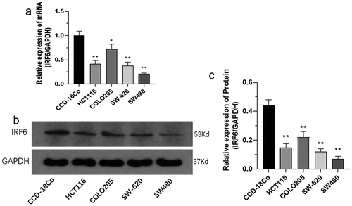 Figure 2. The mRNA and protein expression of IRF6 was measured in CRC cells as HCT116, COLO205, SW-620 and SW480 cell lines along with CCD-18Co. (a) The mRNA expression of IRF6 was measured in CRC cells as HCT116, COLO205, SW-620 and SW480 cell lines and CCD-18Co using qPCR. (b) The protein expression of IRF6 was measured in CRC cells as HCT116, COLO205, SW-620 and SW480 cell lines and CCD-18Co using western blotting. (c) The relative protein expression of IRF6 was analyzed using ImageJ denoted in gray. *p < 0.05, ** p < 0.01 vs CCD-18Co. n = 3.