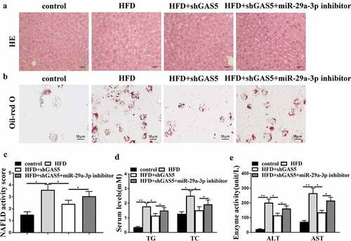 Figure 4. GAS5 promotes NAFLD progression by targeting miR-29a-3p in vivo. (a-f) NAFLD mouse model was established. (a) Hepatic steatosis was measured by H&E staining. (b) Oil Red O staining of liver tissues. (c) NAFLD activity score was quantified. (d) Serum TC and TG levels were analyzed by ELISA. (e) Serum AST and ALT levels were tested by ELISA. Data are presented as mean ± SD. * P < 0.05, ** P < 0.01.