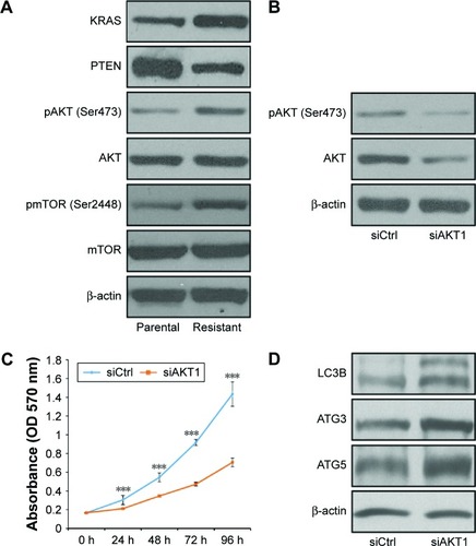 Figure 2 Progestin activates the PI3K/AKT/mTOR pathway in progestin-resistant endometrial cancer cells.