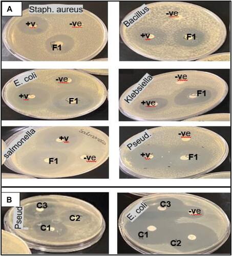 Figure 3 Zone of inhibition of ciprofloxacin on different microbial strains. +ve: control (5 µg of CIP), -ve: blank or non-loaded NLCs. (A) Ciprofloxacin loaded nanostructured lipid carrier (CIP-NLC), (B) spray dried CIP-NLC with different chitosan: lipid ratios (C1: NCMP1, C2: NCMP2, C3 NCMP3).