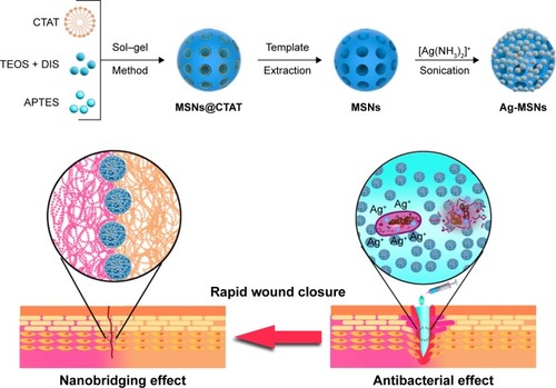 Scheme 1 Schematic representation of synthetic diagram for Ag-MSNs and their nanobridging and antibacterial effect for rapid wound closure.Abbreviations: Ag-MSNs, nanosilver-decorated mesoporous silica nanoparticles; APTES, 3-aminopropyltriethoxysilane; CTAT, etyltrimethylammonium tosylate; DIS, bis(3-triethoxysilyl propyl)disulfide; TEOS, tetraethyl orthosilicate.