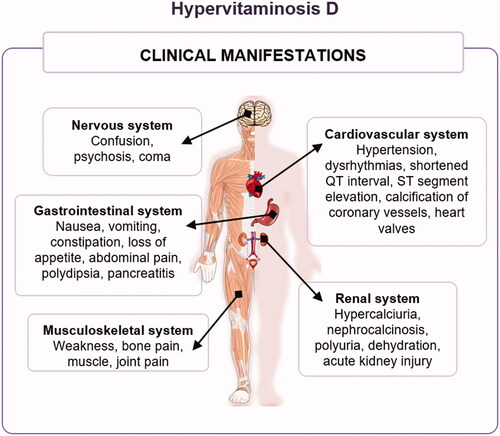 Figure 9. Clinical manifestations of hypervitaminosis D.