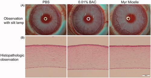 Figure 4. Ocular tolerance observation of the Myr micelle ophthalmic solution. (A) Representative slit-lamp biomicroscopic images of rabbit eyes 24 h after topical instillations. (B) Representative histopathologic images of rabbit corneas 24 h after topical instillations. Myr: myricetin; BAC: benzalkonium chloride. Bar = 100 μm.