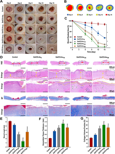 Figure 6 In vivo effects of Gel/CS-AuNPs on accelerated healing of diabetic wounds in the rat model. (A) Sample pictures show the wound bed on days 0, 6, 9, 12, and 15 in the TIIDM rats belonging to the control, Gel/CS-Au5, Gel/CS-Au10, Gel/CS-Au25, and Gel/CS-Au50 groups. Scale bars: 10 mm. (B) Wound traces on days 0, 6, 9, 12, and 15. (C) The line plot shows the changes in the wound residual area (%) in the TIIDM rats belonging to the control, Gel/CS-Au5, Gel/CS-Au10, Gel/CS-Au25, and Gel/CS-Au50 groups on days 0, 6, 9, 12, and 15. (D) Sample pictures show H&E- and MT-stained sections of wounds from the TIIDM rats belonging to the control, Gel/CS-Au5, Gel/CS-Au10, Gel/CS-Au25, and Gel/CS-Au50 groups. Scale bars: 2000 μm; 1000 μm; 200 μm. Red arrow shows wound length. Black dashed box shows the boxed part is enlarged. Green dashed curve shows the dermal tissue boundary at the wound. Yellow arrow shows granulation tissue thickness. Red dashed lines show granulation tissue border. Yellow dashed lines show the boundary of the epidermal layer. Green arrow shows neovascularization. Black arrow shows skin appendages. (E) Histograms show the wound lengths based on H&E staining in the TIIDM rats belonging to the control, Gel/CS-Au5, Gel/CS-Au10, Gel/CS-Au25, and Gel/CS-Au50 groups. (F) Histogram shows the thickness of granulation tissue in the TIIDM rats belonging to the control, Gel/CS-Au5, Gel/CS-Au10, Gel/CS-Au25, and Gel/CS-Au50 groups. (G) Histogram shows the mean collagen deposition in the wound areas of the TIIDM rats belonging to the control, Gel/CS-Au5, Gel/CS-Au10, Gel/CS-Au25, and Gel/CS-Au50 groups. Mean deposition of collagen was based on the specific fluorescent density per field viewpoint. Histograms were plotted with the mean ± standard deviation values (n = 3) (*Denotes P < 0.05 compared with the control group; #Denotes P < 0.05 compared with the Gel/CS-Au5 group; ΔDenotes P < 0.05 compared with the Gel/CS-Au10 group; ◇Denotes P < 0.05 compared with the Gel/CS-Au25 group).