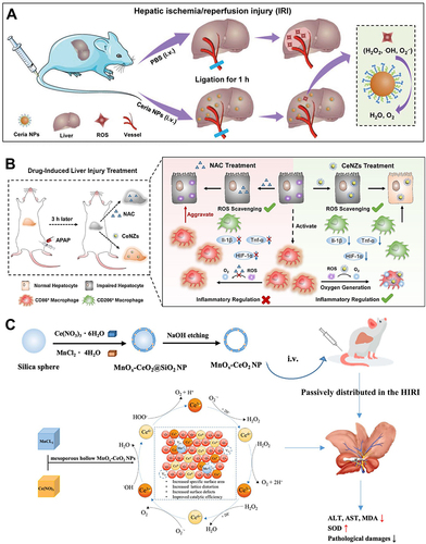 Figure 2 Ce-based nanozymes (CeNZs) for ALI alleviation. (A) Schematic illustration of preventing hepatic ischemia-reperfusion injury by ceria NPs. Reprinted from Ni D, Wei H, Chen W, et al. Ceria nanoparticles meet hepatic ischemia-reperfusion injury: the perfect imperfection. Adv Mater. 2019;31:1902956. © 2019 WILEY-VCH Verlag GmbH & Co. KGaA, Weinheim.Citation35 (B) Schematic mechanism of ceria nanozymes for drug-induced liver injury therapy by dual detoxification and inflammatory regulation. Reprinted from Nano Today, 35, Li F, Qiu Y, Xia F, et al. Dual detoxification and inflammatory regulation by ceria nanozymes for drug-induced liver injury therapy. 100925, copyright 2020, with permission from Elsevier.Citation58 (C) Schematic illustration of the preparation of mesoporous hollow manganese doped ceria nanoparticle and application for effectively prevention of hepatic ischemia reperfusion injury. Reprinted from Dove Medical Press, Si PR, Lei JX, Yang C, et al. Mesoporous hollow manganese doped ceria nanoparticle for effectively prevention of hepatic ischemia reperfusion injury. Int J Nanomedicine. 2023;18:2225–2238.Citation71