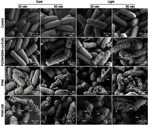Figure 3 SEM images of P. aeruginosa after diverse treatment with different durations with or without light irradiation for 30 mins. Reprinted with permission from Xiao F, Cao B, Wang C, et al. Pathogen-specific polymeric antimicrobials with significant membrane disruption and enhanced photodynamic damage to inhibit highly opportunistic bacteria. The yellow arrows in the images showed the obvious membrane damage of the bacteria. ACS Nano. 2019;13(2):1511–1525.Citation87 Copyright (2019) American Chemistry Society.Abbreviations: P. aeruginosa, Pseudomonas aeruginosa; SEM, scanning electron microscope.