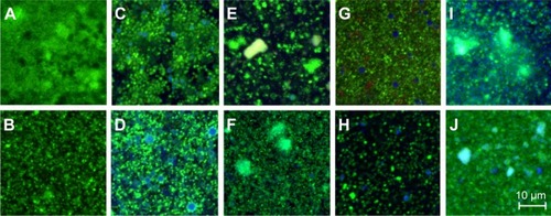 Figure 3 CLSM images of Burkholderia cepacia (A, C, E, G, I) and Staphylococcus aureus (B, D, F, H, J) biofilms.Notes: The images represent biofilm sections located ~2 μm above the glass surface. The biofilms were treated for 4 hours with PBS (A and B), AMCA-PLGA MP (C and D), AMCA-PLGA NP (E and F), Chi-AMCA-PLGA MP (G and H), and Chi-AMCA-PLGA NP (I and J). Viable cells are visualized in green; dead cells are visualized in red; and MP and NP are visualized in blue. The scale bar on image J also applies to images A–H.Abbreviations: AMCA-PLGA, 7-amino-4-methyl-3-coumarinylacetic acid-poly(d,l-lactide-co-glycolide); Chi, chitosan; CLSM, confocal laser scanning microscopy; MP, microparticles; NP, nanoparticles; PBS, phosphate buffered saline.