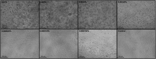 Figure 6. Morphological analysis. Phase-contrast microscopy images of SK-MEL-28 cells treated with different concentrations (% protein) of Broccoli membrane (BM)-vesicles. Scale bars = 200 µm.
