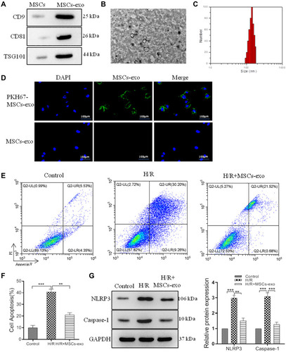 Figure 3 Exosomes derived from MSCs improve pyroptosis in H/R model. We extracted exosomes (30μg protein/mL medium) from MSCs to treat H/R model. (A), relative expression of CD9, CD81 and TSG101 in MSCs-exo and MSCs. (B), representative TEM images of exosomes, scale bar=0.5 μm. (C), representative NTA images of exosomes. (D), representative images of PKH67 green fluorescent labeling for exosomes, scale bar=100 μm. (E), representative images of flow cytometric analysis. (F), histogram of cell apoptosis. (G), relative expression and histogram of NLRP3 and Caspase-1 protein. Values are mean ± SE. **P<0.01, ***P<0.001, n=3 per group.
