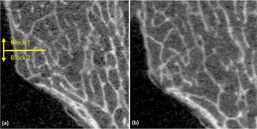 Figure 2. Multi-block scans acquired (a) using the standard scanning procedure, and (b) using the modified scanning procedure. The seam between blocks is visible in the standard procedure, but essentially disappears with the modified protocol.