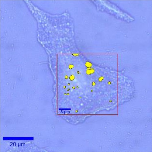 Figure 5 Brightfield image of a tumor cell overlaid with a surface-enhanced Raman scattering intensity image where high intensity signals with a wavenumber of 1,333 cm−1 are visualized in yellow color (cutoff value signal intensity: 4,500 au).