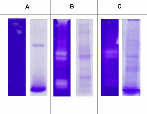 Figure 2 Zymogram and SDS PAGE of (A) negative control (gastric fluid); (B) DLBS1033 from the ex vivo experiment; and (C) DLBS1033 from the in vivo experiment.