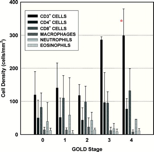 Figure 3 All inflammatory cell populations in each GOLD stage. Values expressed as mean ± SD. *P < 0.05 compared to GOLD 0 and 2.