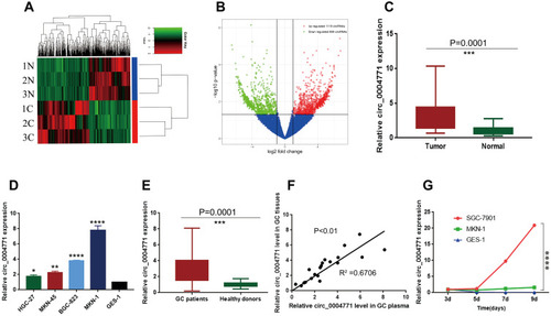 Figure 1 Expression profile of circRNAs in GC and para-cancerous tissues. (A) Clustered heatmap. Each row represents one specimen, and each column represents one circRNA. The color scale reflects the log2 signal strength, from green (low intensity) to black (medium intensity) to red (high intensity). (B) Volcano plots. The red dots represent statistically significant up-regulated circRNAs, the green dots represent statistically significant down-regulated circRNAs. (C) 20 pairs of tissue samples to verify the up-regulation of circ_0004771 (n=20, P=0.0001). (D) Relative expression of circ_0004771 in GC cell lines. (E) Relative expression of circ_0004771 in plasma of initial 20 GC patients (n=20, P=0.0001). (F) A positive correlation of the relative expression of circ_0004771 between plasma and tissues in GC patients (P<0.01, R2=0.6706). (G) Expression level of circ_0004771 in culture supernatants of SGC-7901 increased with time compared to GES-1.