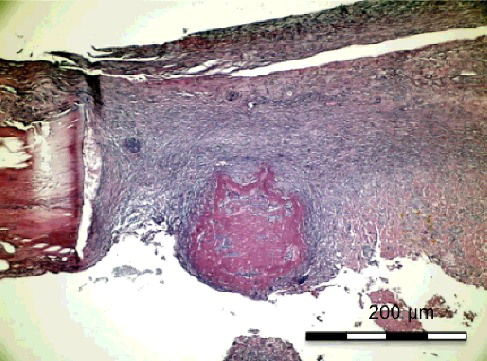 Figure 3. Group II-A with simvastatin. New bone formation with active connective tissue and simvastatin particles (H&E x 100).