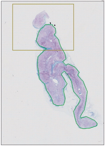 Figure 2. Overview of a super-image of the entire adrenal midsection from one case. Masson’s Trichrome stain. The super-image is a digital composite of individual field of views, generated via automated, sequential capture. Location of current field of view (shown on a second screen connected to the microscope and not visible in this figure) is indicated by the rectangle. The dotted outline is the region of interest (the cross-sectional area), which has been traced by hand.