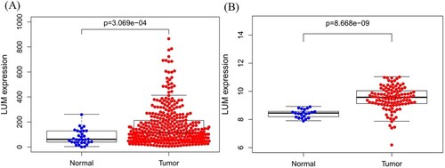 Figure 1. LUM differential expression in normal and tumor tissues. A: comparison of TCGA profile; B: comparison of GEO dataset