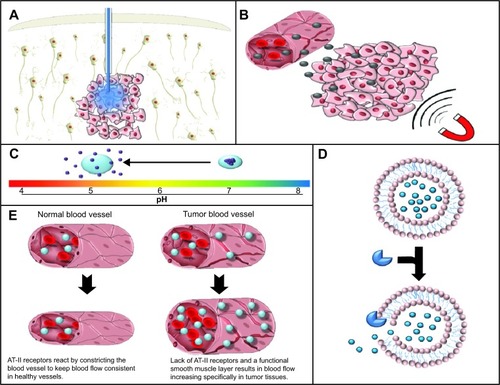 Figure 2 Gross tissue level targeting. (A) Convection enhanced delivery utilizes a positive pressure gradient to cause the dispersion of the active agent through the interstitial space. (B) Magnetic targeting is utilized in order to facilitate the extravasation of magnetic nanoparticles specifically into target tissues using magnetic stimulation. (C) pH-dependent release of drug from nanoconstructs allows specificity of drug release in regions with low pH such as hypoxic tumor regions. (D) Enzyme-mediated release allows release of the active agent from the encapsulating agent specifically in tissue with elevated levels of these enzymes confering a degree of specificity to the site of release. (E) Increased blood pressure, due to the lack of a functional smooth muscle layer and AT-II receptors in tumor blood vessels, allows specific increases in blood flow and subsequently nanomedicine delivery in pathological tissue.Abbreviation: AT-II, angiotensin II.