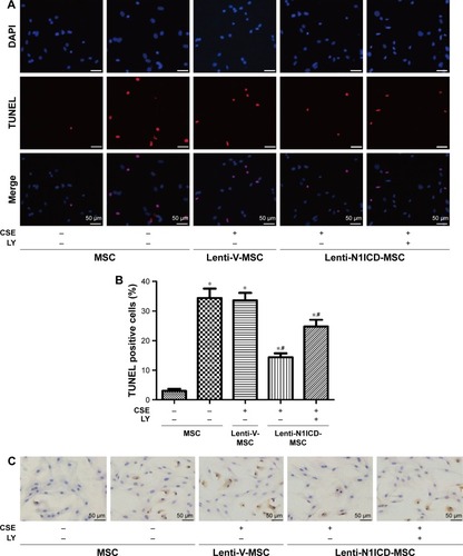 Figure 5 The PI3K/Akt pathway is involved in the anti-apoptotic effects of N1ICD in MSCs after CSE treatment.