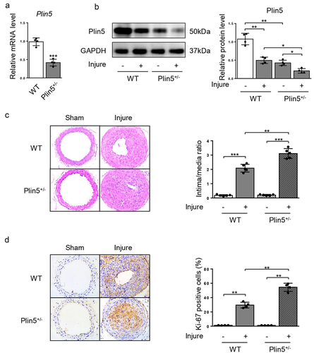 Figure 2. Knockdown of plin5 promotes neointima hyperplasia after vascular injury. The relative mRNA (a) (n = 4) and protein (b) (n = 4) levels of plin5 in common carotid arteries from WT or Plin5± mice. (c) Representative H&E staining of carotid arteries from WT or Plin5± mice at day 28 after sham operation or wire injury (left) and corresponding quantification for ratio of intima/media (right) were shown (n = 5). Magnification 200 × . (d) Immunohistochemistry staining of Ki-67 (brown) in sections of carotid arteries from WT or Plin5± mice at day 28 after sham operation or wire injury (left) and corresponding quantification for Ki-67 positive cells within neointima (right) were shown (n = 4). Magnification 200 × . *P < 0.05, **P < 0.01 and ***P < 0.001 denote statistical comparison between the two marked groups, respectively. Data are shown as mean ± S.D.