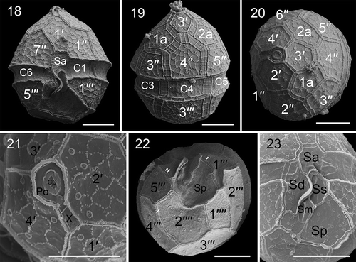 Figs 18–23. Scanning electron micrographs of vegetative cells of Parvodinium parvulum strain TIO879. Fig. 18. Ventral view showing the first apical plate, anterior sulcal plate (Sa), and three cingular plates (C1, C2, C6). Fig. 19. Dorsal view showing two anterior intercalary plates (1a, 2a), three precingular plates (3′′–5′′), three cingular plates (C3–C5) and third postcingular plate (3′′′). Fig. 20. Apical view showing three apical plates (2′–4′), two anterior intercalary plates and six precingular plates (1′′–6′′). Fig. 21. Apical view showing four apical plates, pore plate (Po), cover plate (cp), canal plate (X) and apical pore. Fig. 22. Antapical view showing five postcingular plates (1′′′– 5′′′), two antapical plates (1′′′′, 2′′′′) of unequal size and numerous papillae (arrows). Fig. 23. Sulcal area showing Sa plate, Sd plate, Ss plate, Sm plate and Sp plate. Scale bars = 5 μm