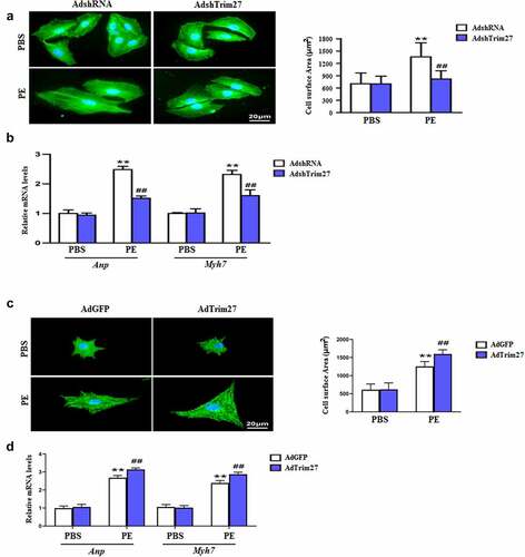 Figure 4. Trim27 promotes phenylephrine (PE)-induced cardiomyocyte hypertrophy. (a) Representative images of cardiomyocytes (immunostained with the α-actinin antibody) infected with Ad-shTrim27 or Ad-shRNA after treatment with PE (100 μM) for 24 hours and quantification analysis (n = 4 independent experiments). Scale bars, 20 μm. **P < 0.01 vs. PBS- AdshRNA, ##P < 0.01 vs. PE- AdshRNA. (b) Atrial natriuretic peptide (ANP) and Myh7 mRNA levels in NRCMs after PE treatment. The real-time polymerase chain reaction analysis was performed. n = 4 per group, **P < 0.01 vs. PBS- AdshRNA, ##P < 0.01 vs. PE- AdshRNA. (c) Representative images of cardiomyocytes (immunostained with the α-actinin antibody) infected with AdTrim27 or AdGFP after treatment with PE (100 μM) for 24 hours and quantification analysis (n = 4 independent experiments). Scale bars, 20 μm. **P < 0.01 vs. PBS-AdGFP, ##P < 0.01 vs. PE-AdGFP. (d) Atrial natriuretic peptide (ANP) and Myh7 mRNA levels in NRCMs after PE treatment. The real-time PCR analysis was performed. n = 4 per group, **P < 0.01 vs. PBS-AdGFP, ##P < 0.01 vs. PE-AdGFP.