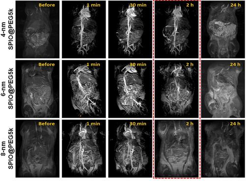 Figure 3 MRA images of SD rats before and after intravenous injection of SPIO@PEG nanoparticles. High contrast imaging more than 2 h is obtained in the 4-nm SPIO@PEG5k group.