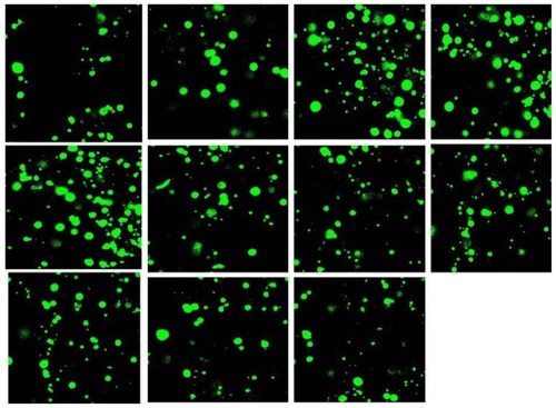 Figure 9 Z scan of osteoblast cultured within gellan xanthan gels at a scan depth of 200 microns.