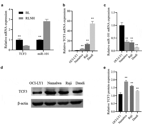 Figure 1. The expression of TCF3 and miR-101 in Burkitt lymphoma tissues and lymphoma cells