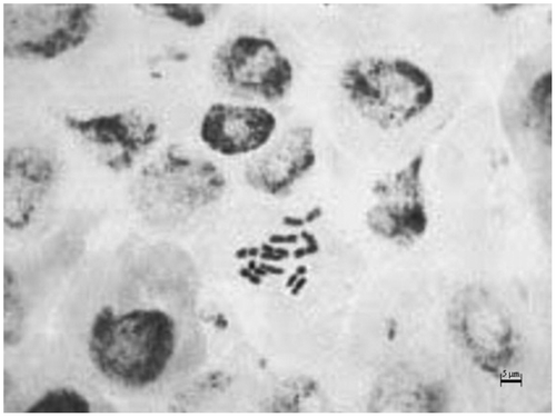 Figure 1. Somatic chromosomes in Matthiola anchoniifolia (scale bar: 5 μm).