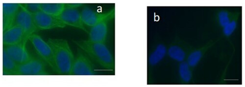 Figure 2. Immunofluorescence staining in the neuroblastoma SH-SY5Y cells using a monoclonal anti-tubulin antibody. In panel a, untreated cells are displayed and the label shows a clear localisation in the cytoskeletal microtubules (green). In panel b, the fluorescent signal appears weak and limited in the reduced cytoplasm, losing its organisation in cells treated with DTX. The nuclei (DAPI blue-fluorescent DNA stain) appeared altered, panel b. Bar 20 μm.