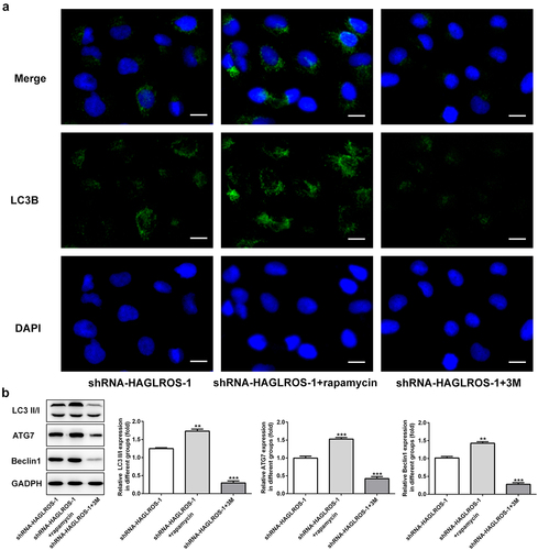 Figure 5. The autophagy in HFWT cells after transfection with shRNA-HAGLROS-1.(a) Level of LC3II in cells transfected with shRNA-HAGLROS-1 with rapamycin or 3 M was examined by immunofluorescence staining. Scale bar: 50 μm. (b) Western blot was employed to calculate the levels of LC3II/I, ATG7 and Beclin1 in HAGLROS silenced cells with rapamycin or 3 M. **P < 0.01, ***P < 0.001 versus control.