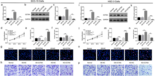 Figure 2. CCT6A induced OSCC malignant behaviors. CCT6A mRNA expression (a) and protein expression (b, c) after transfection into SCC-15 cells. Effect of CCT6A on cell proliferation (d), cell apoptosis rate (e, g) and invasive cell count (f, h) in SCC-15 cells. CCT6A mRNA expression (i) and protein expression (j, k) after transfection into HSC-3 cells. Effect of CCT6A on cell proliferation (i), cell apoptosis rate (m, o) and invasive cell count (n, p) in HSC-3 cells.