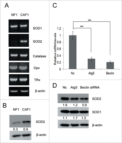 Figure 5. SOD2 levels increase in CAFs and can be down-regulated by autophagy blockage. (A) RT-PCR analysis of indicated antioxidant genes in NFs and CAFs. (B) Western blot analysis of SOD2 protein levels in NF1 and CAF1 cells. The relative intensity of indicated proteins normalized to housekeeping protein was shown at the bottom of each panel. (C) qRT-PCR analysis of SOD2 mRNA levels transiently transfected with the indicated siRNA for 48 h. (D) Western blot analysis of the protein levels of SOD1 and SOD2 in CAFs transiently transfected with the indicated siRNA for 48 h. The relative intensity of indicated proteins normalized to housekeeping protein was shown at the bottom of each panel.
