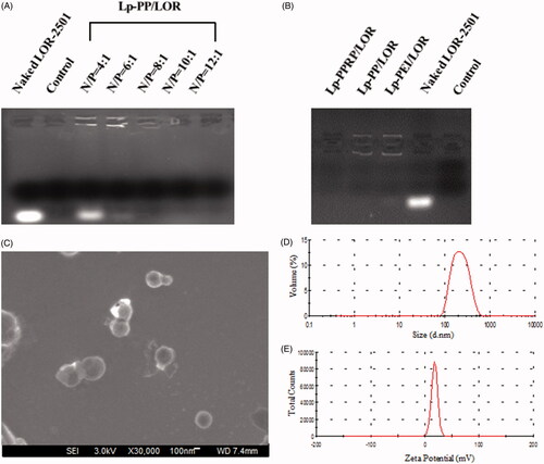 Figure 3. Agarose gel electrophoresis retardation assay of Lp-PP/LOR, Lp-PPRP/LOR and the characterization of Lp-PPRP/LOR. (A) Agarose gel electrophoresis retardation assay of Lp-PP/LOR at varying N/P ratios. (B) Agarose gel electrophoresis retardation assay of Lp-PPRP/LOR. (C) FE-SEM image of Lp-PPRP/LOR at R8-PA/total lipid ratio = 20%. (D) Diameter distribution of Lp-PPRP/LOR at R8-PA/total lipid ratio = 20%. (E) Zeta potential distribution of Lp-PPRP/LOR at R8-PA/total lipid ratio = 20%.