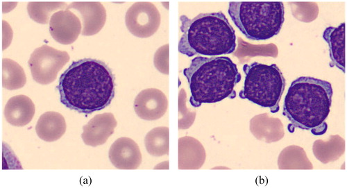 Figure 1. One target cell per image (a) and multiple target cells per image (b).