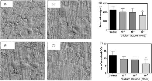 Figure 4. Cnidium lactone inhibited the resorbed area on bone slices. (A) Control group, (B) cnidium lactone group (10−4 mol/L), (C) cnidium lactone group (10−5 mol/L), (D) cnidium lactone group (10−6 mol/L), (E) quantification of resorbed bone surface and (F) quantification of number of resorbed OCs. *p < 0.05 compared with control group (0 mol/L cnidium lactone).