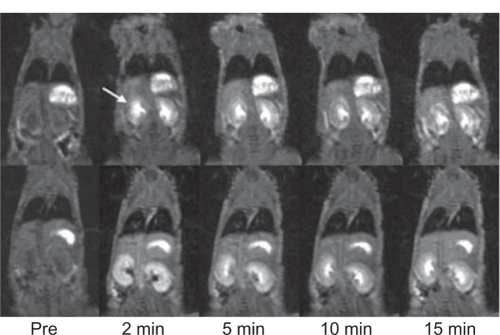 Figure 3 Contrast-enhanced coronal magnetic resonance images of nude mice before (pre) and at various time points after intravenous injection of nanoglobule-G4-cystamine-(Gd-DO3A; top panel) and Gd(DTPA-BMA; lower panel). Arrows point to the kidney.