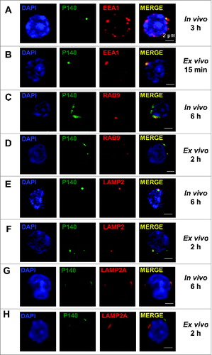 Figure 3. Colocalization of the P140 peptide with endolysosomal markers and components. (A, C, E, G) MRL/lpr mice received Alexa Fluor 488 labeled-P140 peptide (100 μg/mouse) by the iv route. Splenocytes were collected 3 h later and stained for the early endosomal marker EEA1 (A), or 6 h later and stained for the late endosomal marker RAB9 (C), lysosomal component LAMP2 (E) or LAMP2A isoform (G). Representative results of 3 independent experiments are shown. (B, D, F, H) B cells from MRL/lpr mice were incubated for 15 min (B) or 2 h (D, F, H) in the presence of Alexa Fluor 488 labeled-P140 peptide and stained for EEA1 (B), RAB9 (D) LAMP2 (F) or LAMP2A isoform (H). Representative results of 2 to 4 independent experiments are shown (2 different experimenters).