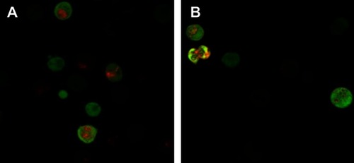 Figure 7 Confocal microscopy observation of CQ inhibition of autophagy induction of BEZ235 (A panel is BEZ235 1 μM 24 h group, B panel is CQ40 μM+BEZ235 1 μM 24 h group).