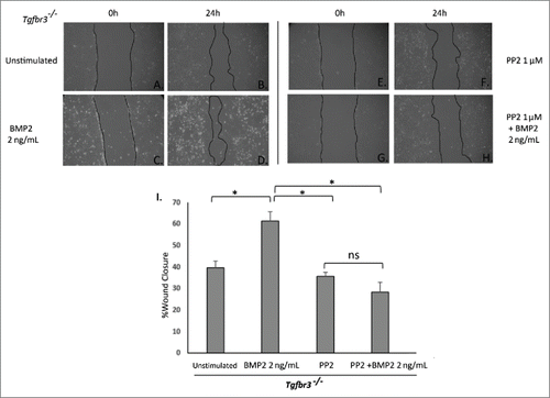 Figure 4. Src is required for BMP2-stimulated Tgbr3−/− epicardial cell migration. Tgfbr3−/− epicardial cells were subjected to the wound healing assay and allowed to close the wound for 24 hours in the presence (C-D) or absence (A-B) of BMP2 (2 ng/mL). Tgfbr3−/− epicardial cells were subjected to the wound healing assay and allowed to migrate for 24 hours in the presence of 1 µM PP2 with (G-H) or without (E-F) BMP2 (2 ng/mL).( *=p < 0.05).